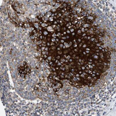 Immunohistochemistry-Paraffin: TOMM6 Antibody [NBP1-90688]