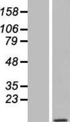 Western Blot: TOMM7 Overexpression Lysate [NBL1-17193]