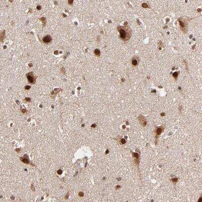 Immunohistochemistry-Paraffin: TOP1MT Antibody [NBP1-89473]