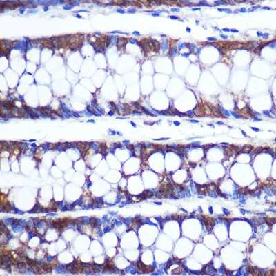 Immunohistochemistry-Paraffin: TOP1MT Antibody - Azide and BSA Free [NBP2-93237]