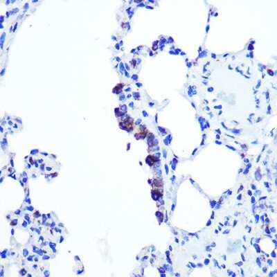 Immunohistochemistry-Paraffin: TOP1MT Antibody - Azide and BSA Free [NBP2-93237]