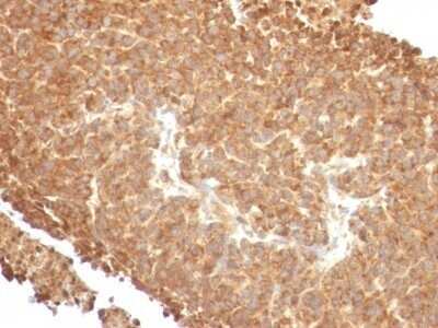 Immunohistochemistry-Paraffin: TOP1MT Antibody (TOP1MT/488) - Azide and BSA Free [NBP2-47793]