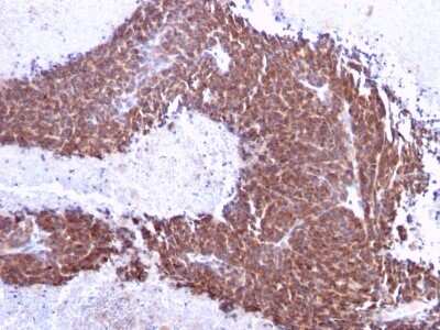 Immunohistochemistry-Paraffin: TOP1MT Antibody (TOP1MT/613) - Azide and BSA Free [NBP3-08306]