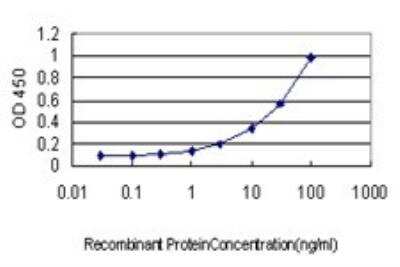 ELISA: TOP2A Antibody (1E2) [H00007153-M01]
