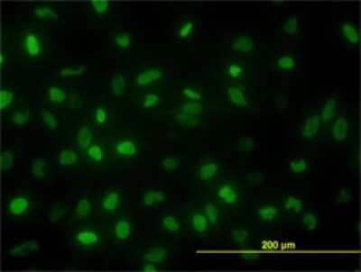 Immunocytochemistry/ Immunofluorescence: TOP2A Antibody (1E2) [H00007153-M01]