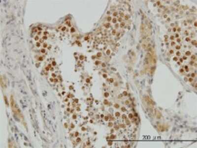 Immunohistochemistry-Paraffin: TOP2A Antibody (1E2) [H00007153-M01]
