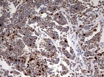 Immunohistochemistry: TOP2A Antibody (OTI2A9) [NBP2-46184]