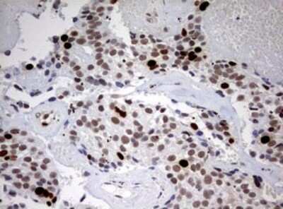 Immunohistochemistry: TOP2A Antibody (OTI2A9) - Azide and BSA Free [NBP2-74558]