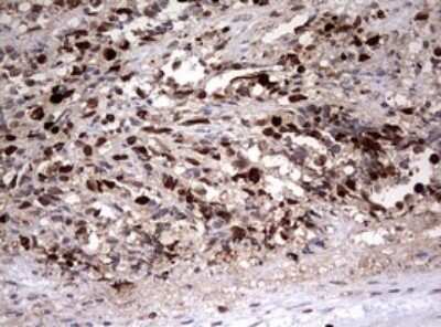 Immunohistochemistry: TOP2A Antibody (OTI2A9) - Azide and BSA Free [NBP2-74558]