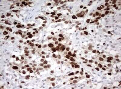 Immunohistochemistry: TOP2A Antibody (OTI2A9) - Azide and BSA Free [NBP2-74558]