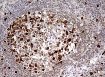 Immunohistochemistry: TOP2A Antibody (OTI2A9) - Azide and BSA Free [NBP2-74558]