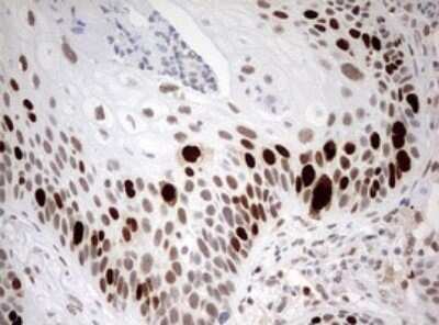 Immunohistochemistry: TOP2A Antibody (OTI2A9) - Azide and BSA Free [NBP2-74558]