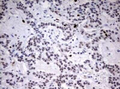 Immunohistochemistry: TOP2A Antibody (OTI2A9) - Azide and BSA Free [NBP2-74558]
