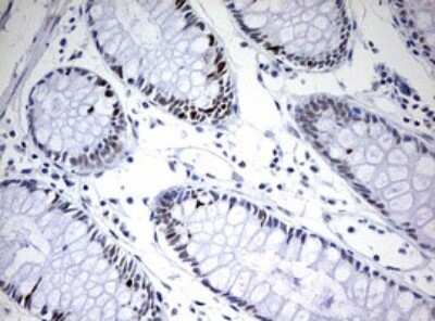 Immunohistochemistry: TOP2A Antibody (OTI2A9) - Azide and BSA Free [NBP2-74558]