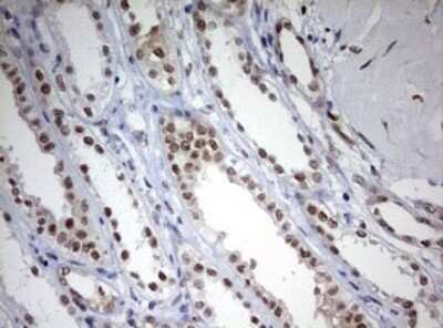 Immunohistochemistry: TOP2A Antibody (OTI2A9) - Azide and BSA Free [NBP2-74558]