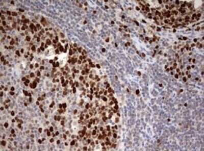 Immunohistochemistry: TOP2A Antibody (OTI2A9) - Azide and BSA Free [NBP2-74558]