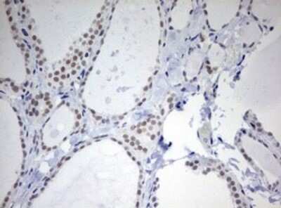 Immunohistochemistry: TOP2A Antibody (OTI2A9) - Azide and BSA Free [NBP2-74558]