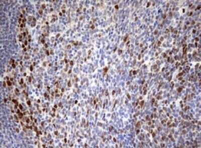 Immunohistochemistry: TOP2A Antibody (OTI2A9) - Azide and BSA Free [NBP2-74558]