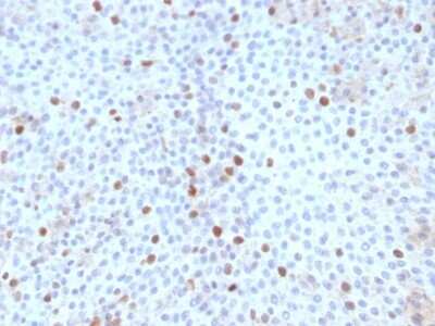 Immunohistochemistry-Paraffin: TOP2A Antibody (TOP2A/1361) [NBP2-53281]