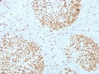 Immunohistochemistry-Paraffin: TOP2A Antibody (TOP2A/1361) [NBP2-53281]