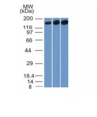 Western Blot: TOP2A Antibody (TOP2A/1361) [NBP2-53281]