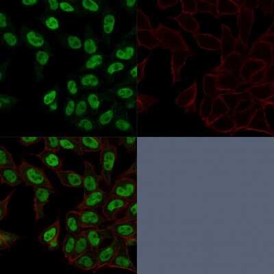 Immunocytochemistry/ Immunofluorescence: TOP2A Antibody (TOP2A/1362) [NBP2-53282]
