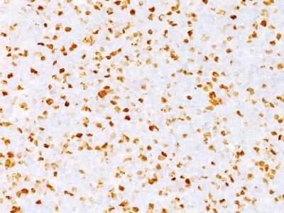 Immunohistochemistry-Paraffin: TOP2A Antibody (TOP2A/1362) [NBP2-53282]