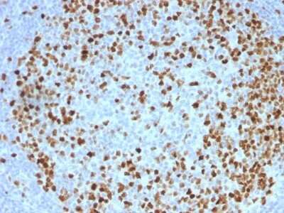 Immunohistochemistry-Paraffin: TOP2A Antibody (TOP2A/1362) [NBP2-53282]