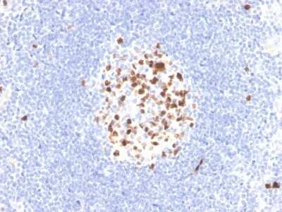 Immunohistochemistry-Paraffin: TOP2A Antibody (TOP2A/4397R) - Azide and BSA Free [NBP3-08756]
