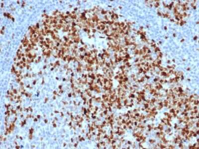 Immunohistochemistry-Paraffin: TOP2A Antibody (TOP2A/6570R) [NBP3-07736]