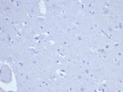 Immunohistochemistry-Paraffin: TOP2A Antibody (TOP2A/6570R) [NBP3-07736]