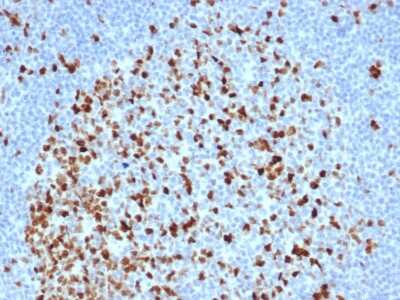 Immunohistochemistry-Paraffin: TOP2A Antibody (TOP2A/6570R) [NBP3-07736]
