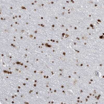 Immunohistochemistry-Paraffin: TOP2B Antibody [NBP1-89527]