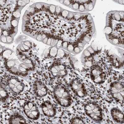 Immunohistochemistry-Paraffin: TOP2B Antibody [NBP1-89527]