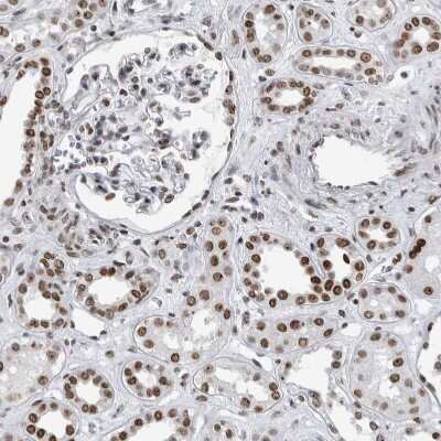 Immunohistochemistry-Paraffin: TOP2B Antibody [NBP1-89527]