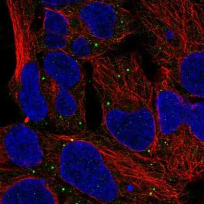 Immunocytochemistry/ Immunofluorescence: TOR/mTOR Antibody [NBP2-55920]