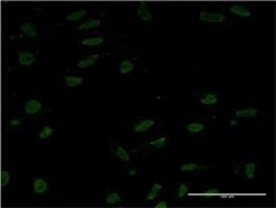 Immunocytochemistry/ Immunofluorescence: TORC1 Antibody (8F9) [H00023373-M01]