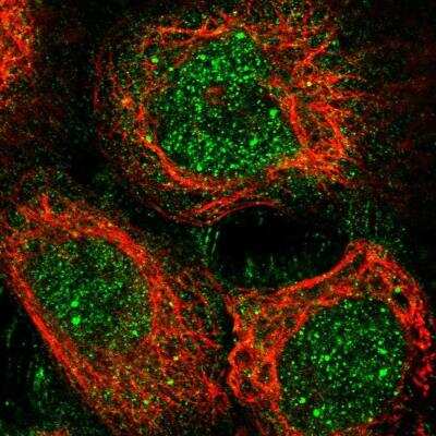 Immunocytochemistry/ Immunofluorescence: TORC1 Antibody [NBP1-89865]
