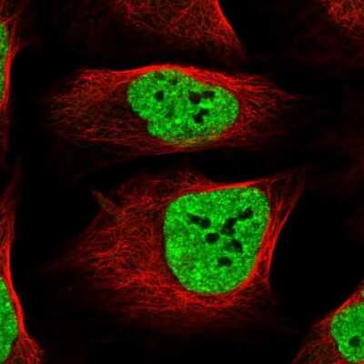 Immunocytochemistry/ Immunofluorescence: TORC2 Antibody [NBP1-86925]