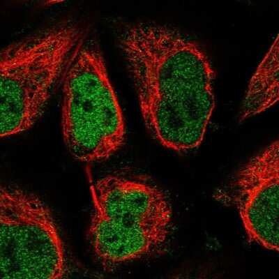 Immunocytochemistry/ Immunofluorescence: TORC2 Antibody [NBP1-86926]