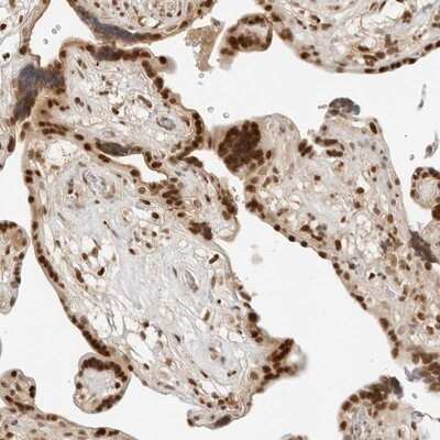 Immunohistochemistry-Paraffin: TORC2 Antibody [NBP1-86926]