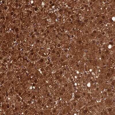 Immunohistochemistry-Paraffin: TORC3/CRTC3 Antibody [NBP1-83615]