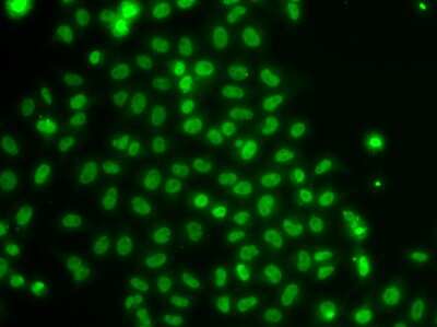Immunocytochemistry/ Immunofluorescence: TOX Antibody - Azide and BSA Free [NBP3-04932]