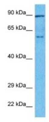 Western Blot: TOX Antibody [NBP3-10305]