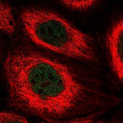 Immunocytochemistry/ Immunofluorescence: TOX2 Antibody [NBP2-13464]