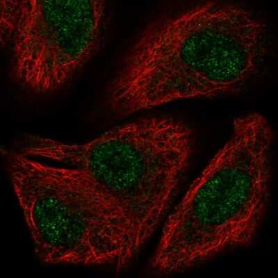 Immunocytochemistry/ Immunofluorescence: TOX2 Antibody [NBP2-58503]
