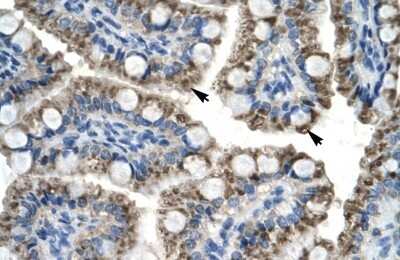 Immunohistochemistry-Paraffin: TOX2 Antibody [NBP1-79964]