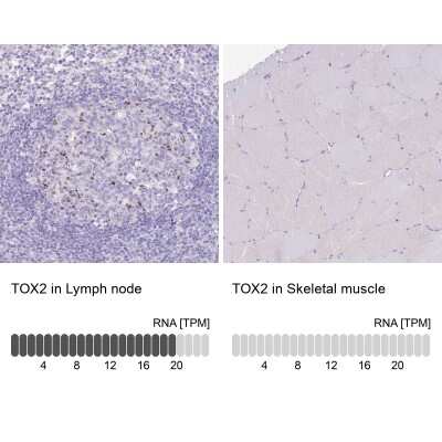 Immunohistochemistry-Paraffin: TOX2 Antibody [NBP2-13464]