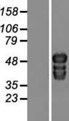 Western Blot: TOX2 Overexpression Lysate [NBP2-09307]