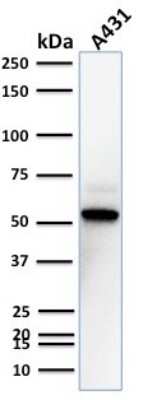 Western Blot: TOX3 Antibody (TOX3/1123)Azide and BSA Free [NBP2-47748]